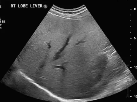 Sonographer holding an ultrasound probe against a patient's abdomen