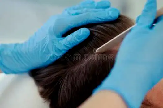Clinician parting a patient's hair to examine the scalp under a bright examination light