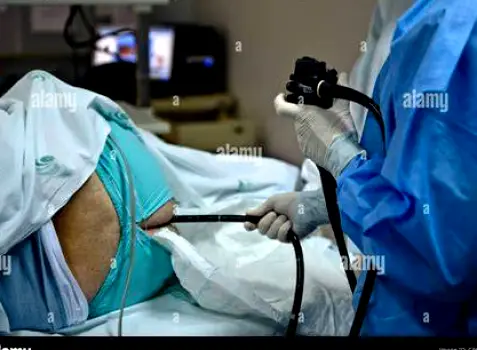 A clinician performing a colonoscopy to view the bowel lining
