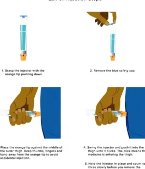 Person standing with right thigh exposed, holding an EpiPen auto-injector poised to administer medication into the anterolateral thigh
