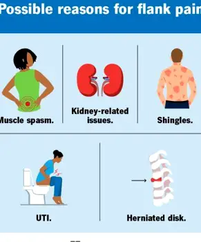 Person clutching their side and lower back in discomfort, head tilted, suggesting waves of flank pain