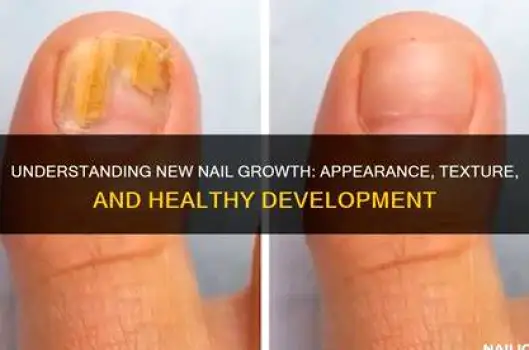 Side-by-side comparison of a damaged fungal toenail and a healthy nail showing new clear growth emerging from the cuticle