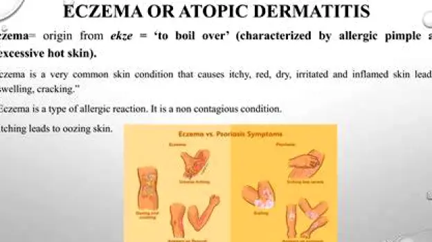 Close-up of inflamed skin with redness, blistering, and peeling indicating a local reaction to medication