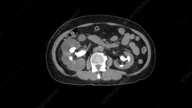 Medical imaging scanner in an examination room used to examine the kidneys