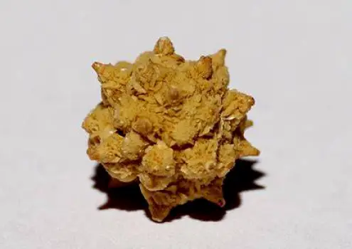 Close-up of a jagged kidney stone resting on a smooth medical surface