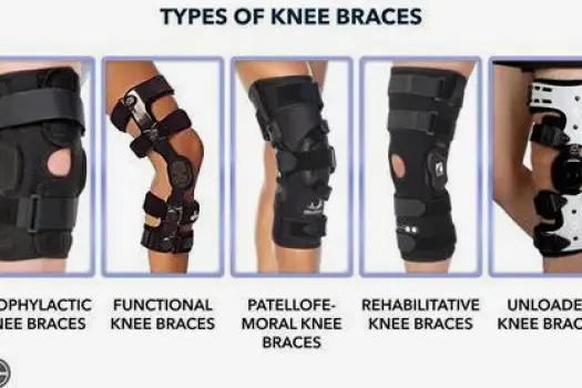 Five knee brace types for arthritis: unloader brace with rigid frame and straps, patellofemoral brace with patellar cutout, hinged brace with side hinges, compression sleeve, and immobilizer
