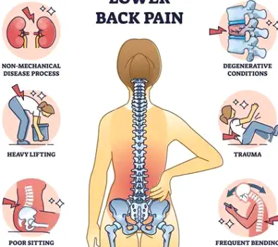 Person pressing a hand against their lower back with a pained expression, reflecting the lower back pain and pressure felt during early labor.
