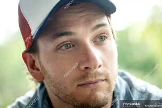 Person wearing a baseball cap with sweat on the forehead illustrating occlusion and friction from headwear mentioned as a trigger.