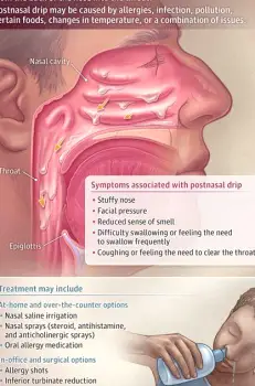 Close-up illustration of mucus accumulation in the back of the throat with a subtle drip from the nasal cavity