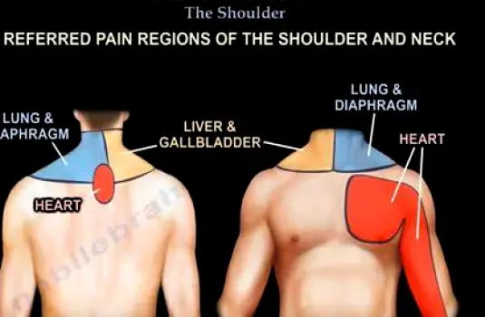 Person reaching a hand toward the right shoulder blade area