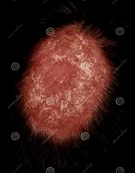 Close-up of a red, flaky, and inflamed patch of skin visible along a hair part on the scalp.