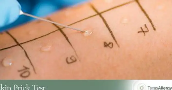Clinician performing a skin-prick test, creating a small raised bump on a person's arm