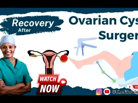 Surgical team performing a minimally invasive operation for an ovarian cyst complication