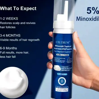 Hand applying liquid minoxidil solution directly to the top of the scalp with a dropper