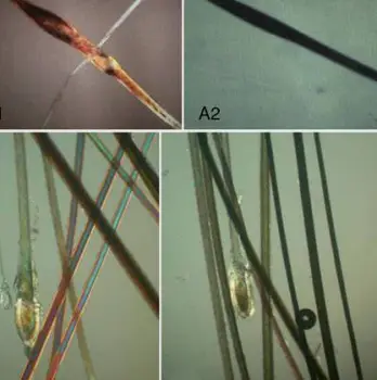 Microscopic view of individual hair shafts arranged for a trichogram analysis to measure thickness and follicular characteristics