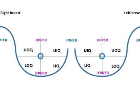 Illustration of a woman's upper breast showing the upper outer quadrant extending toward the armpit and collarbone area.